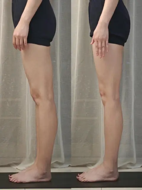img1-after img1-after