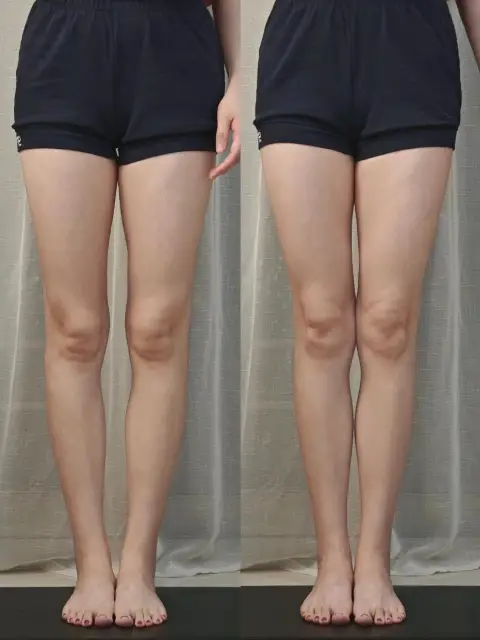 img1-before img1-before